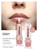 D1403_lips