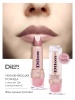 D1406_lips